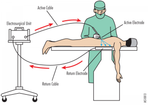 Current_flow_typical_electrosurgical_unit