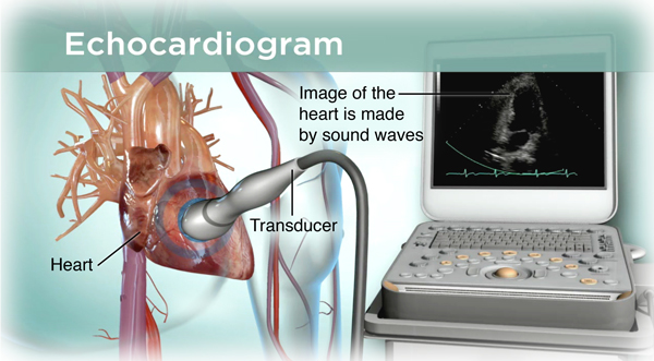 Echo cardiography